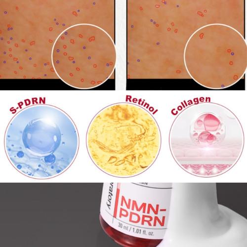 CNP Derma Answer Pore Firming Ampoule 15ml