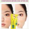 Fade Dark Spot Astragalus Cream Remove Dark Yellow Skin Moisturize Lotion Brighten Cream  Face Skin