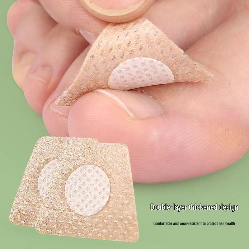 Ochranná náplast na zarostlý nehet: Jemná péče o nehtové lůžko a onychomykózu