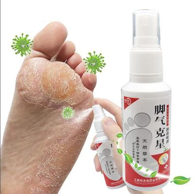 20ml Herbal Foot Spray, Foot Sweat, Foot Odor, Itching Relieving Spray, Odor Peeling Foot Care Spray