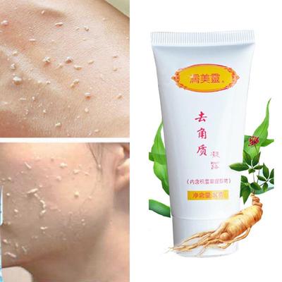 Deep Clean פילינג לנקבוביות Scrub Facial Clean Gel 30 גרם פילינג פילינג לפנים