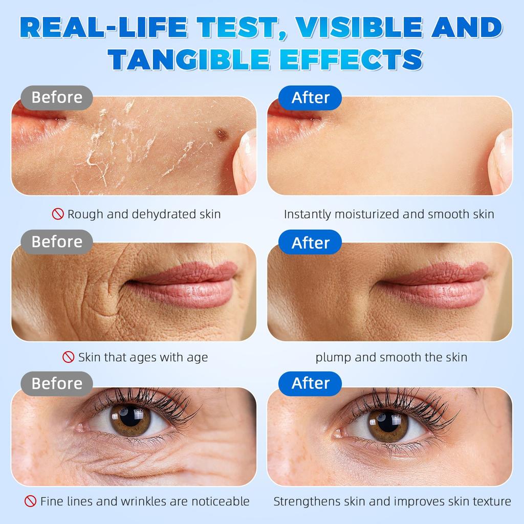 Hyaluronserum Ultra Feuchtigkeitsspendende Ampulle, Ultra Feuchtigkeitsspendendes Serum Hyaluron Feuchtigkeitsspendendes Gesichtsserum(1.2ML*30