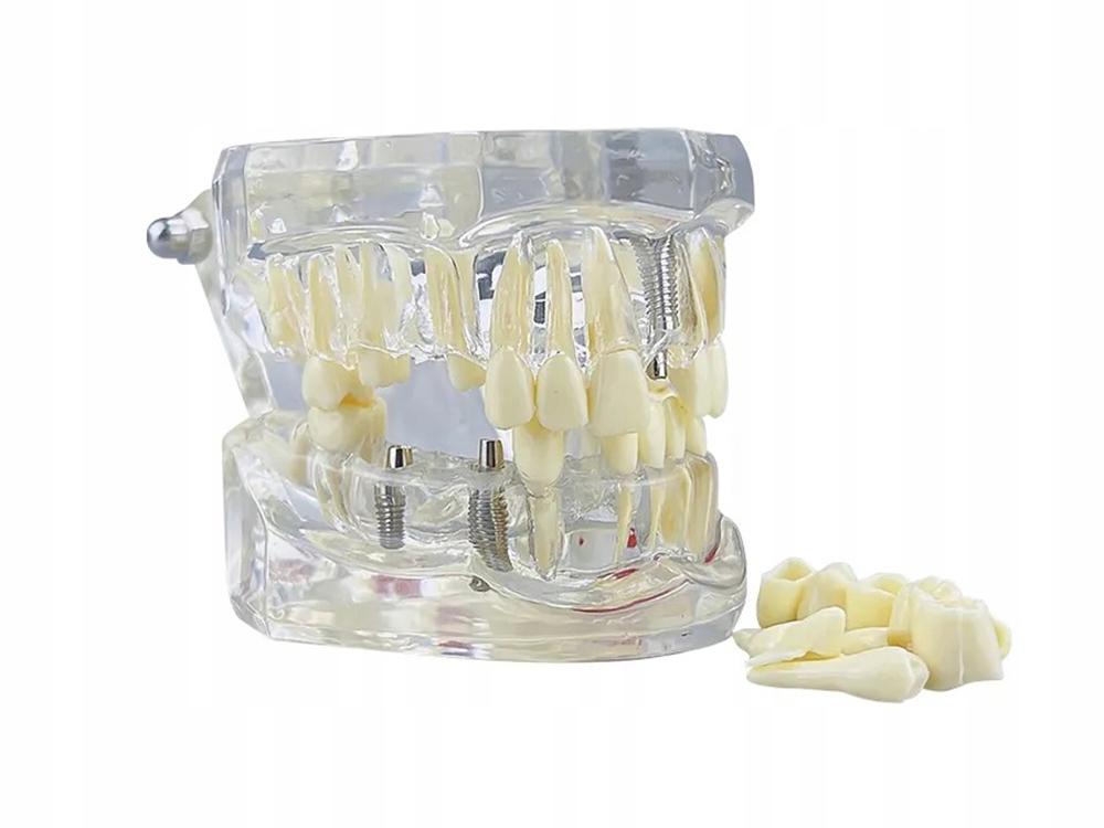 Dental Model 2 White (100) Gab_B