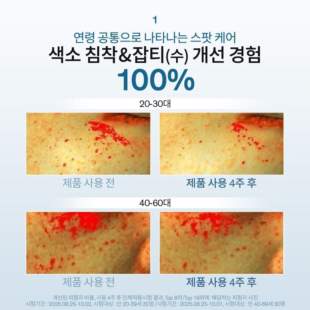 Sulwhasoo [Common] JaJung Dark Spot Corrector 30ml Special Set