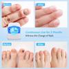 Effective Remover Fungus Machine Repair Nail Laser Fungus Device Damage Rechargeable Cleaning Nail Phototherapy Auxiliary Tools