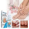 3pcs Nail Repair Spray Repair And Clean Nails, Hands, Feet, Soft Nails, Thicken Nails, Polish Nails 100ml