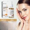 Eelhoe Turmeric Correction Essence Facial Care Hydrating And Moisturizing Gentle Skin Care Essence
