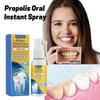 Oralhoe Propolis Oral Care Spray Cleans Stains And Tartar, Eliminates Odors, Freshens Breath And Whitens Teeth