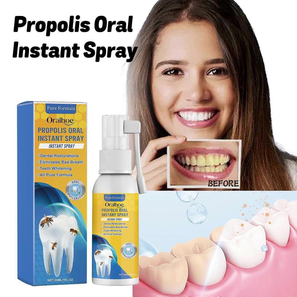 Oralhoe Propolis Oral Care Spray Cleans Stains And Tartar, Eliminates Odors, Freshens Breath And Whitens Teeth