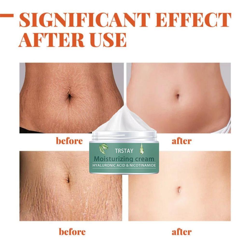 Pregnant Woman Stretch Mark Repair Cream Postpartum Repair and Fade Stretch Marks