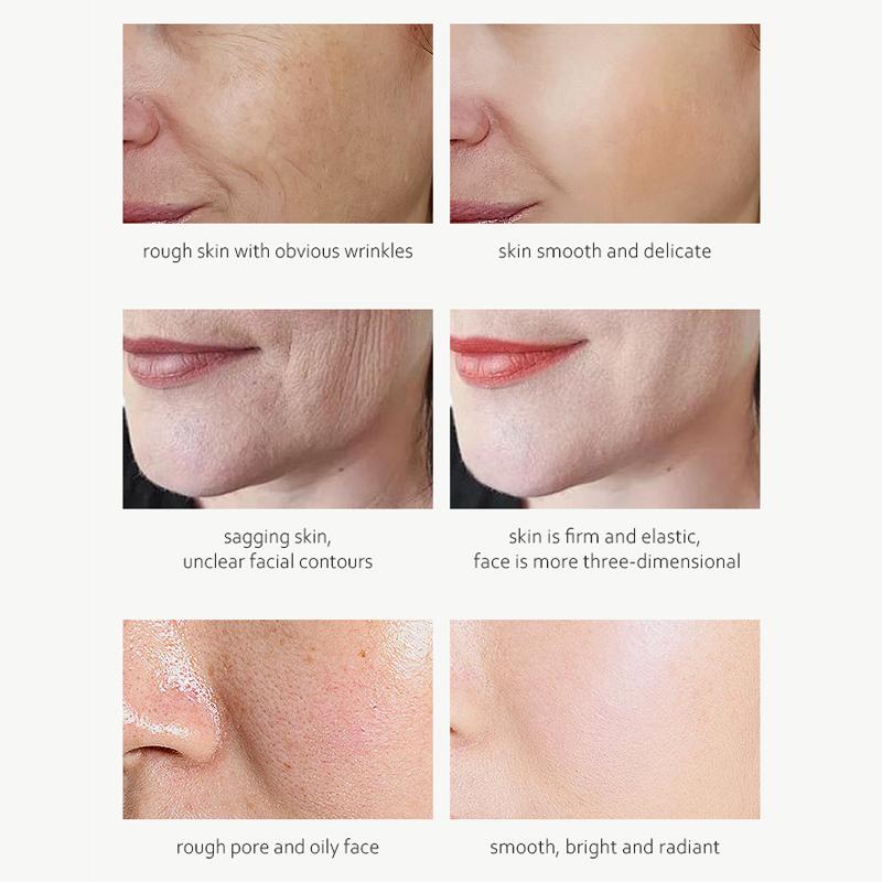 BELYN BERLY 'Morning C Evening A' Face Serum Kit for Fade Melanin Lifting and Moisturizing Retinol + Vitamin C Facial Serum