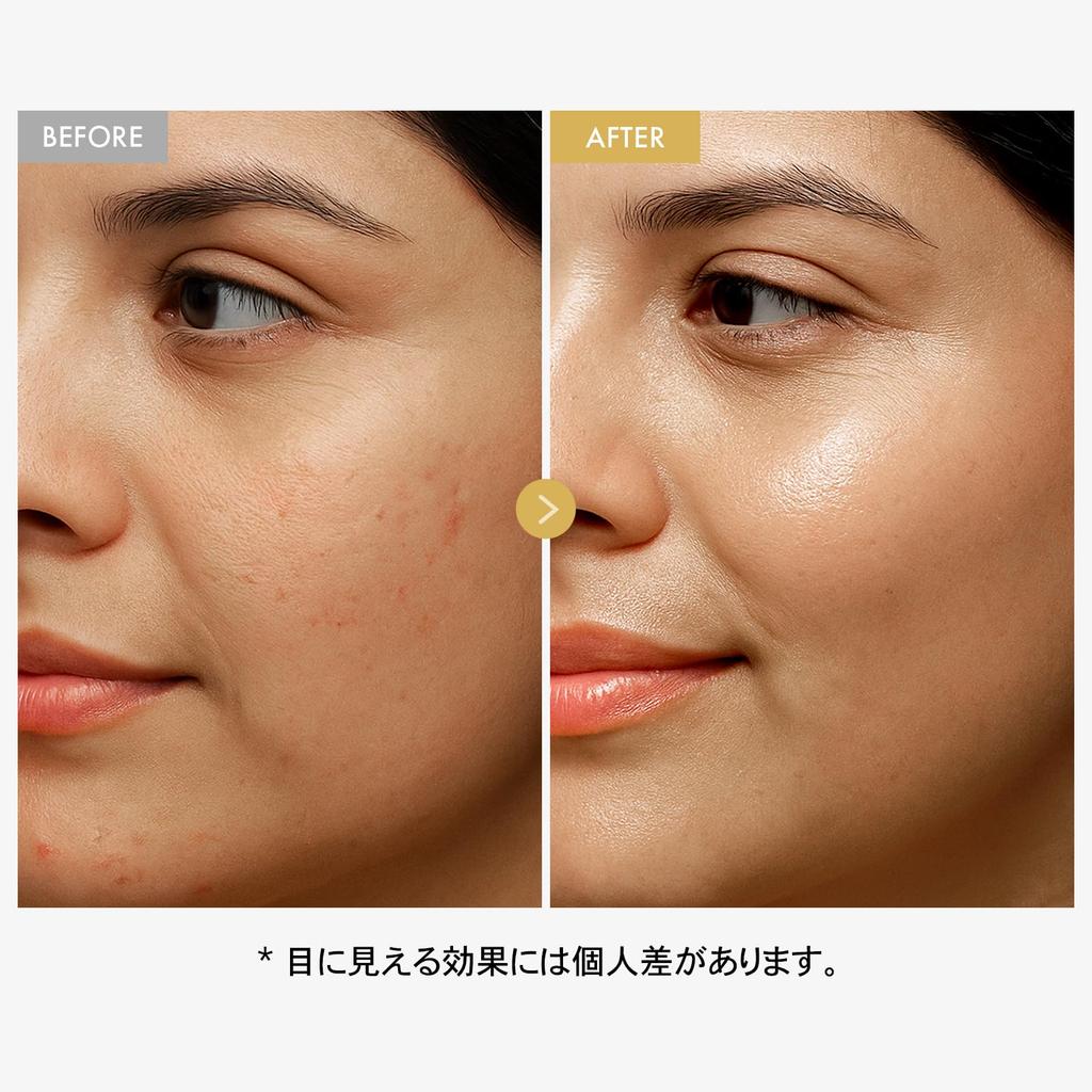 TOSOWOONG Glow Soy Face Moisturizing Cream with Fermented Hyaluronic and and Glowing for Dry and Combination by Korean Skincare Cosmetics Cream, 50ml,