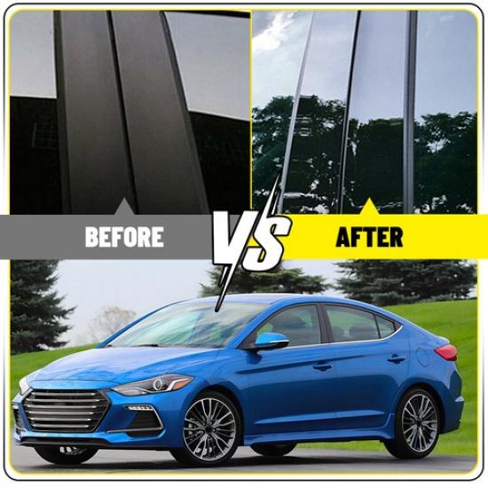 Black Window Door Pillar Posts Cover Trim Fits Hyundai Elantra/Avante 2017-20 EV