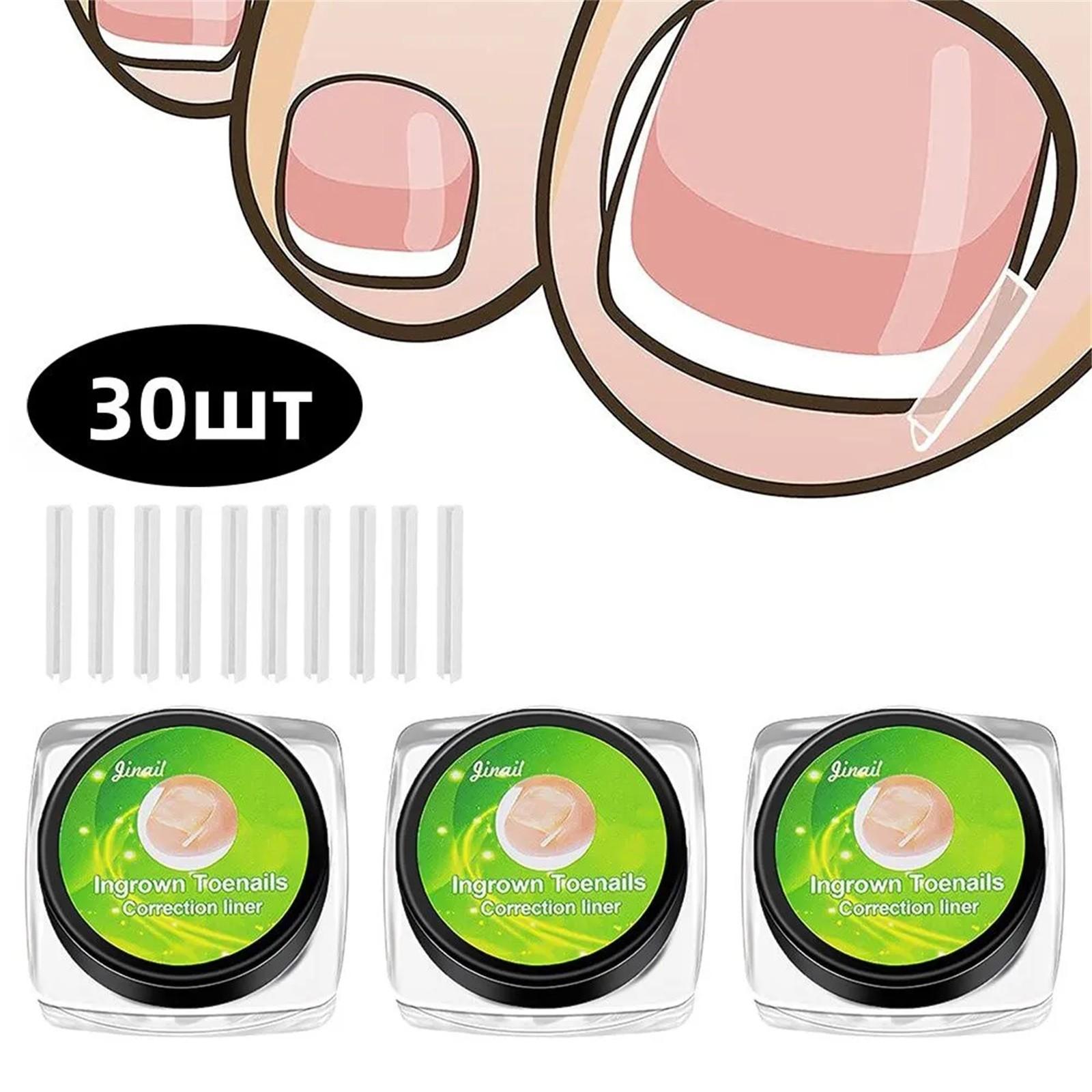 

20 шт. Подушечка для заполнения вросшего ногтя, рукав, подушечка для ногтя, С-образная подушечка для ногтя, корректор вросшего ногтя, инструмент для педикюра One Size белый