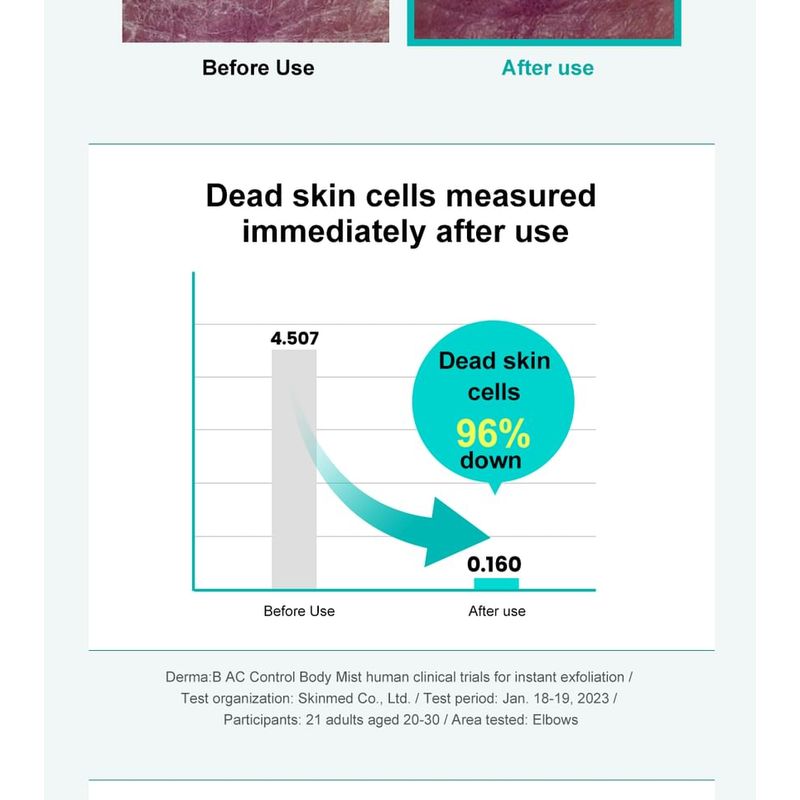 Derma: B - AC Control Body Mist