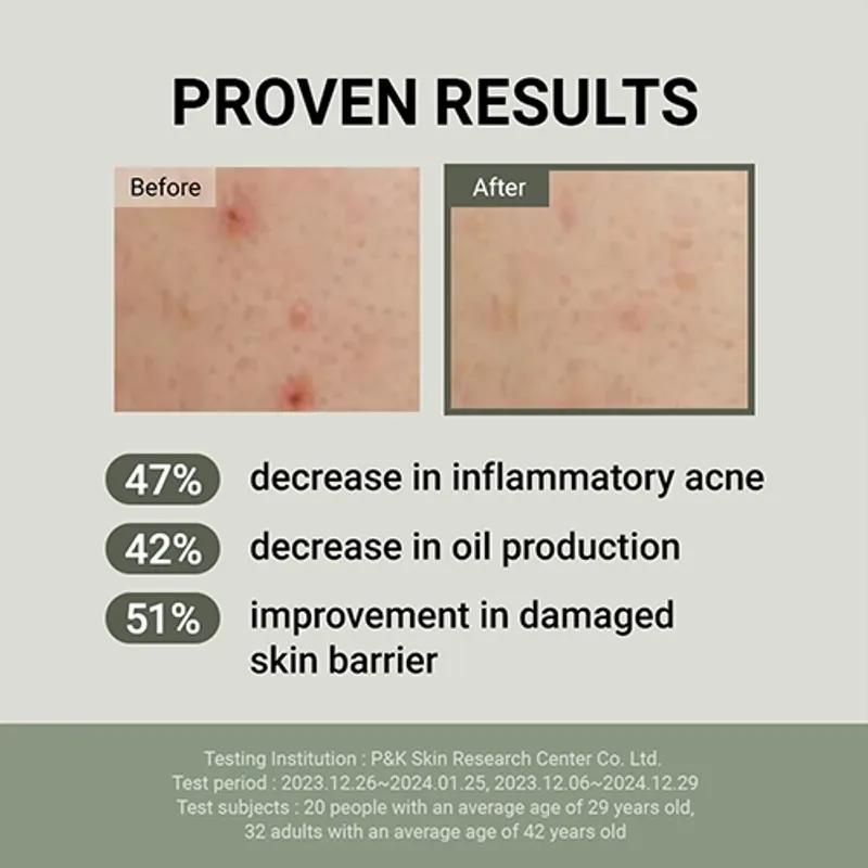 jumiso Schneckenmucin 88 + Peptidcreme 100ml