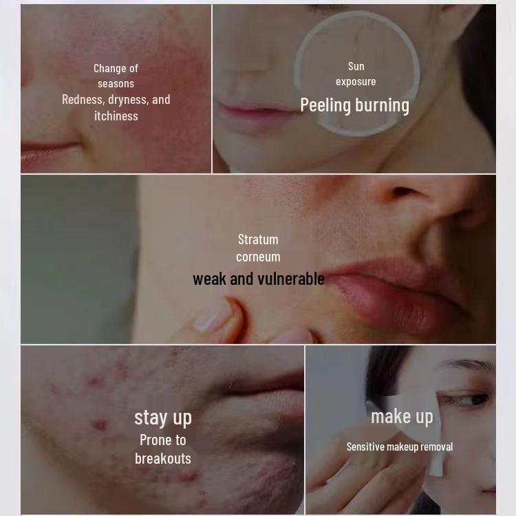 Repair & Protect: Daily Moisturizing Lotion for Tender Skin