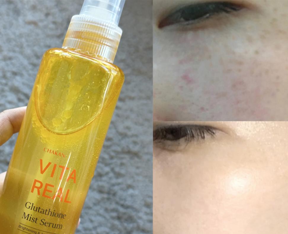 [CHAKAN] Vita Real Glutathione Mist Serum (Brightening & Anti-Wrinkle) 150ml For Freckles Improvement