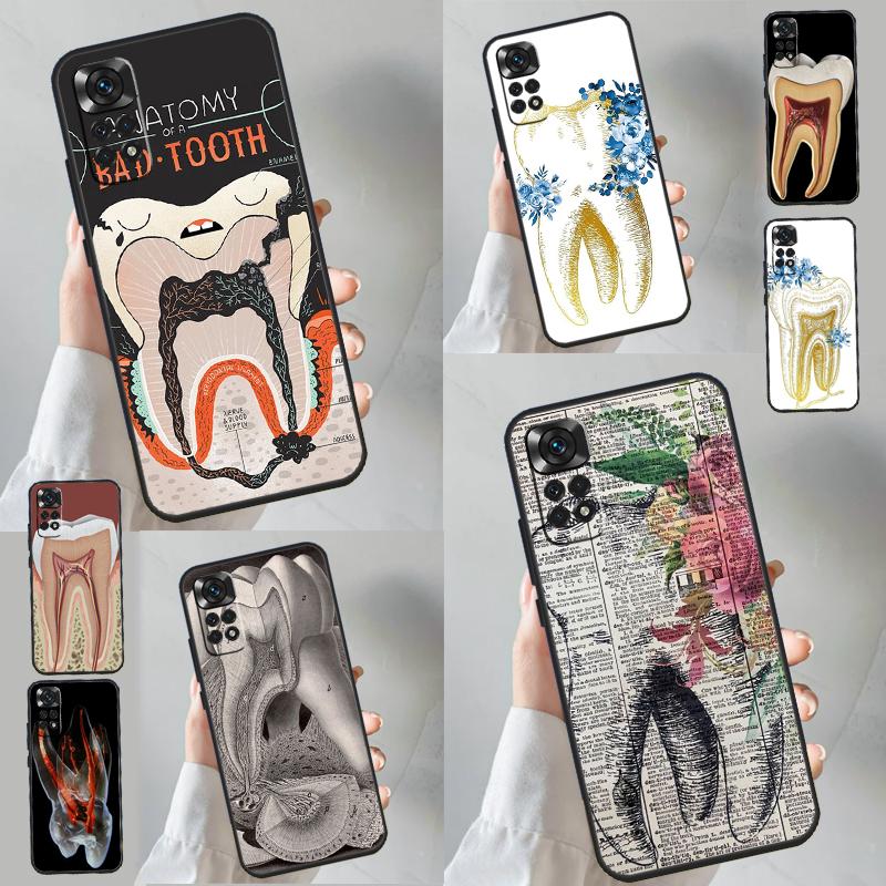 Human Tooth Anatomy Case For Xiaomi Redmi Note 13 11 10 9 8 12 Pro Plus 12S 11S 10S 9S 10A 9C 10C 12C 13C Funda