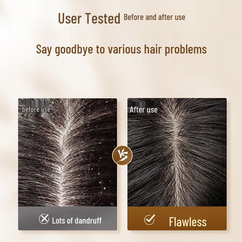 ZuoLanYa Anti-Dandruff Soothing Shampoo