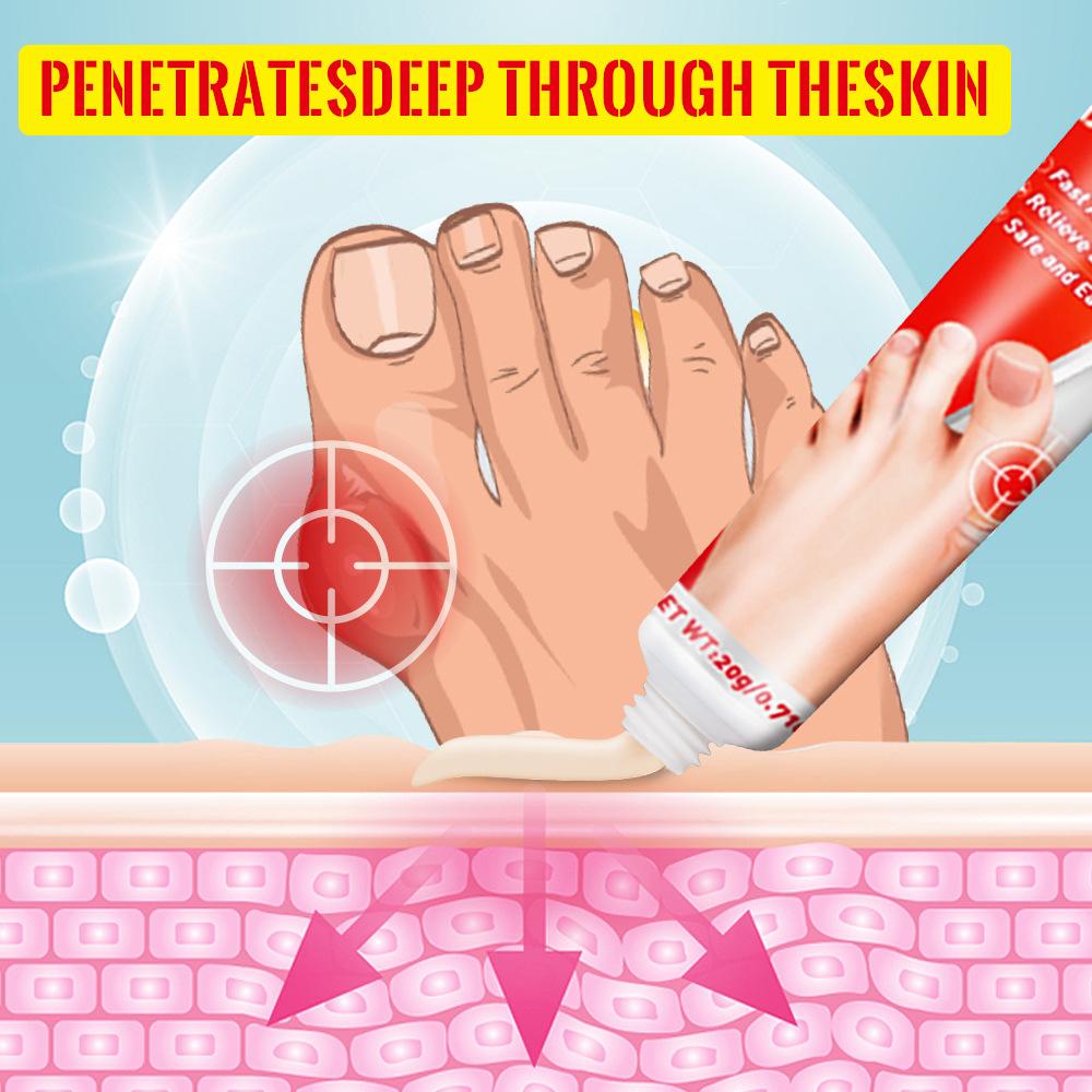 Sumifun Ballensalbe Gelenkpflegecreme 20g Ballenbalsam