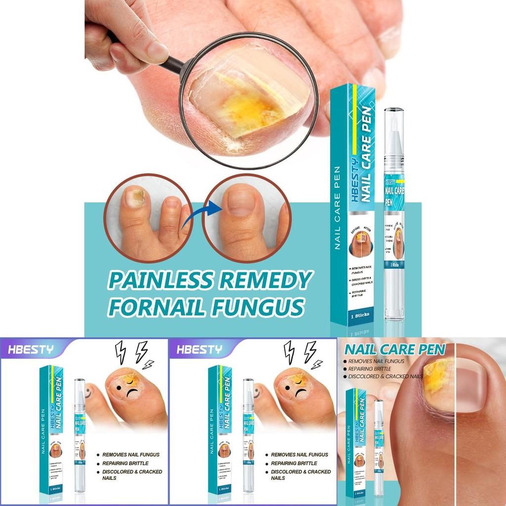 Hbesty Nagelpflege Stift Kräuterduftende Fußbehandlung für gesunde Nägel und Haut