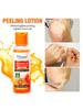 1Pc 100g Peeling Lotion Effectively Soften The Keratin, Improve Rough Epidermis,Delay Skin Aging And