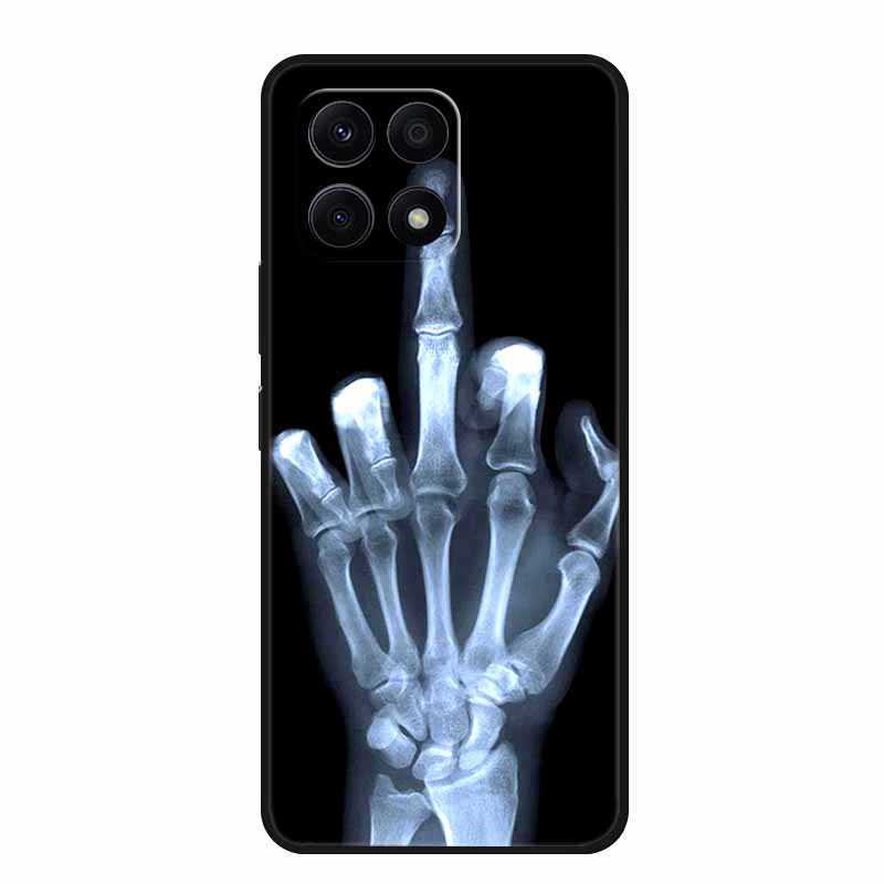 For Honor X6B Case Soft Printed Lion Wolf TPU Silicone Cover for Huawei Honor X6b Case JDY-LX1 Protection HonorX6b Girl Covers