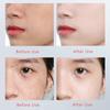 MERCILEN 577 Whitening Essence 50ml Brightens Skin Tone and Softens Skin Arbutin Stock Essence