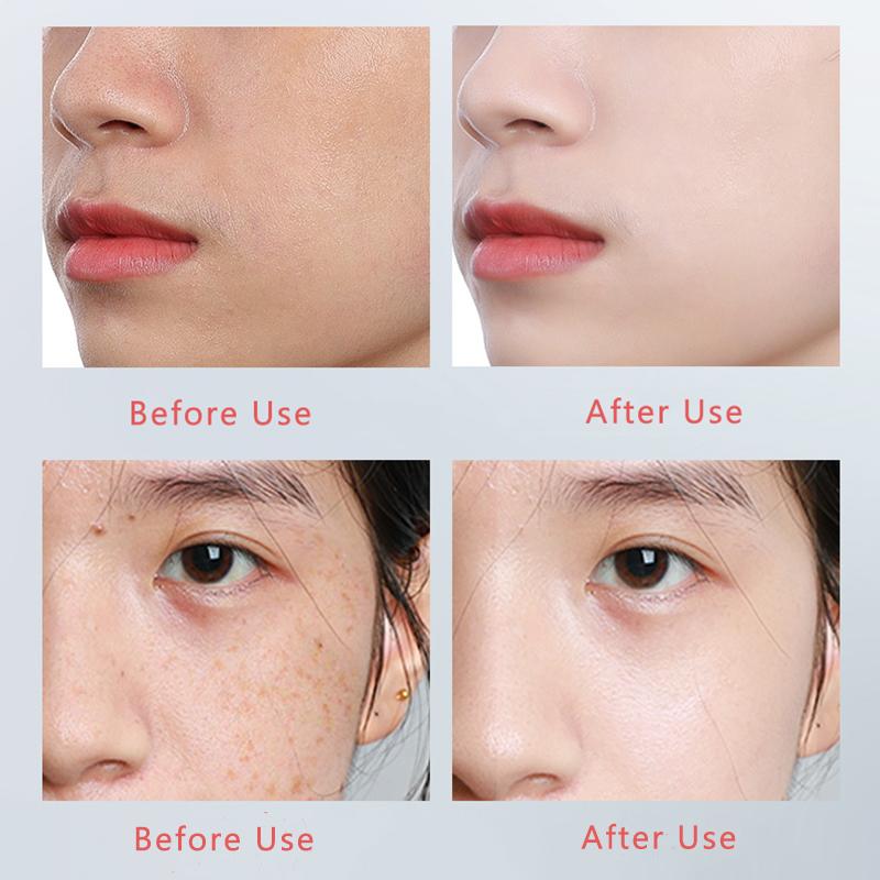 MERCILEN 577 Whitening Essence 50ml Brightens Skin Tone and Softens Skin Arbutin Stock Essence