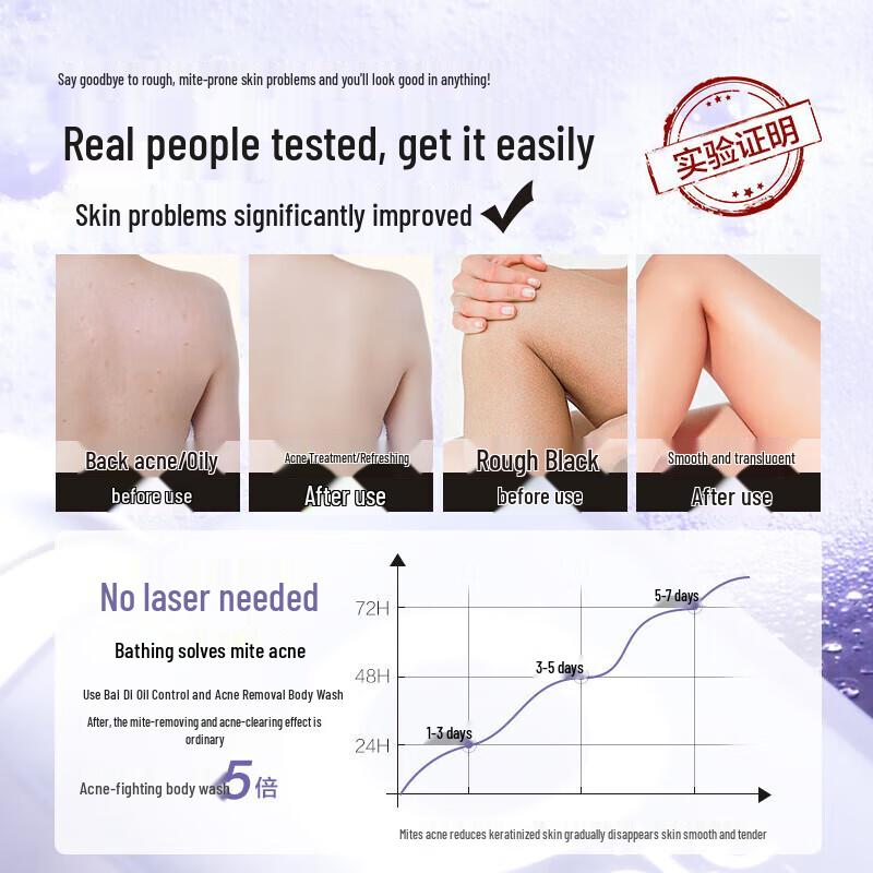 Baitini Oil Control Acne Removal Shower Gel