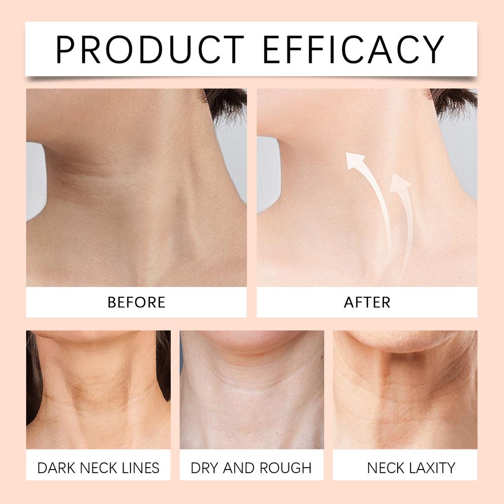 Firming And Moisturizing Neck Cream, Neck Wrinkle Moisturizing Cream, Skin Conditioning, Firming And Anti-wrinkle Moisturizing Cream.