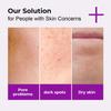Azelaic Acid Serum-Eliminate Acne And Acne Scars-Inhibit The Growth Of Melanin-Soothing and Repairing Skin-Suitable For All Skin Types, 30ml