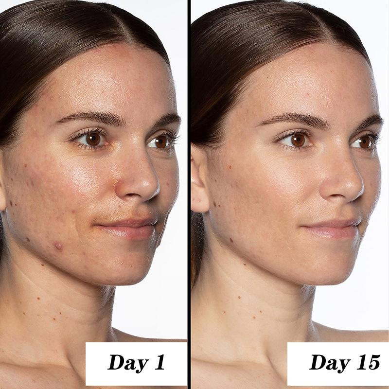 50ml Duckbill Press Bottle Snail Essence Face Cream Mooth Delicate Radiant and Translucent Rapid Absorption of Skin Retinol Anti Aging Serum