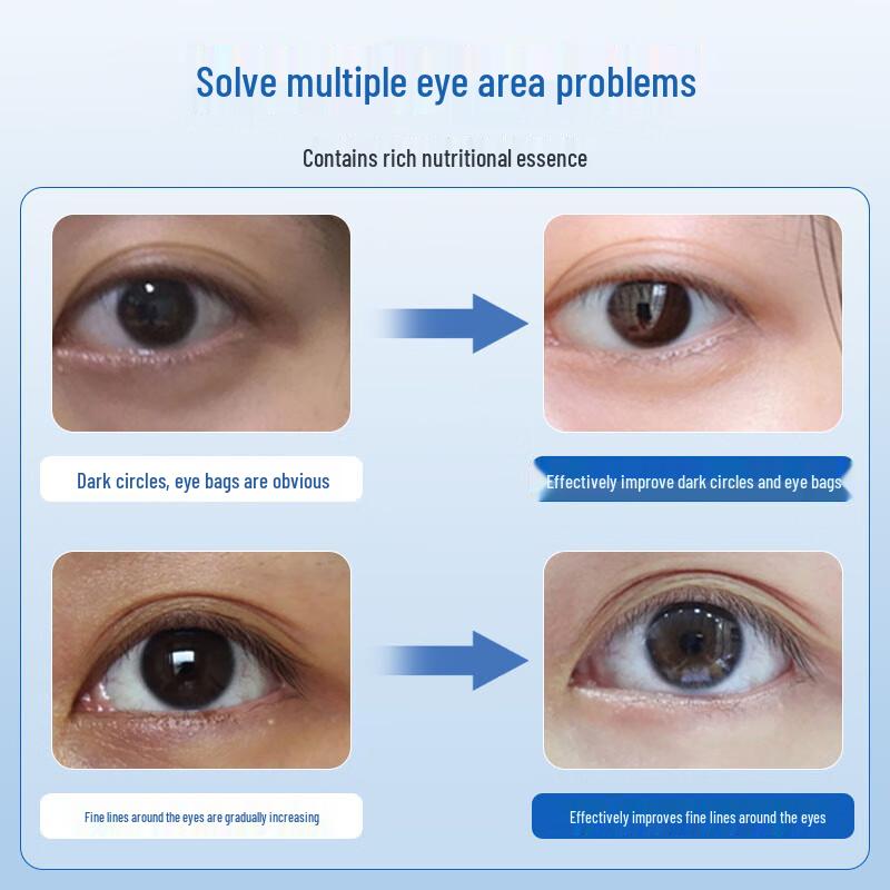 Sakose Firming & Anti-Wrinkle Eye Masks