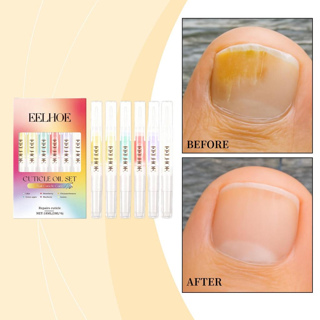 Flüssig-Set zur Nagelpflege Effektive Reparatur von Nägeln Vorbeugung von Nagelbruch Sanfte tägliche nährende Pflege Feuchtigkeitsspendende Nagelpflege-Lösung