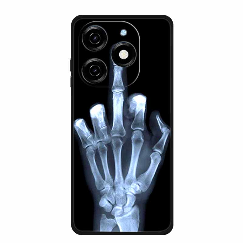 For Blackview Shark 9 5G Case Animals Soft Silicone TPU Phone Cases Back Cover for Blackview Shark9 Fashion Shockproof Fundas