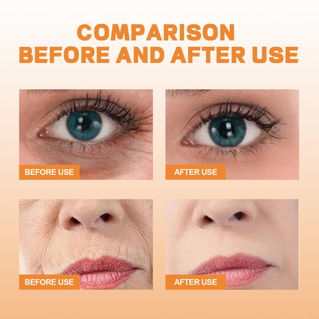 EELHOE  Collagen Eye Mask Spray Set Eye Nourishing Care Collagen Nourishing & Hydrating Eye Masks