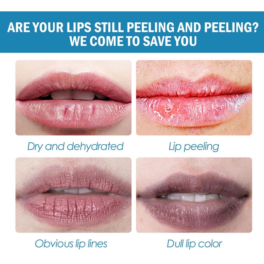 EELHOE Moisturizing Lip Gloss, Deeply Hydrates and Moisturizes, Repairs Lips, Prevents Dryness and Cracking, Nourishes and Protects Lips, 3ml