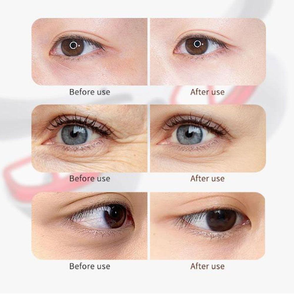 Red Light Eye Massager Microcurrent Eye Massage Instrument Eye Beauty Device  Eye Puffiness