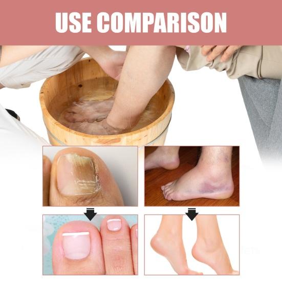 Essential Oil Bath Tablets Repair Calluses & Relieve Soreness And Swelling Body Cleaning