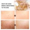 Spots Peel Off Facial Mask Freckle Pigmentation Removal Cream Chloasma Care Dark Spot Correction Glow Whiten Peeling Mask Strong