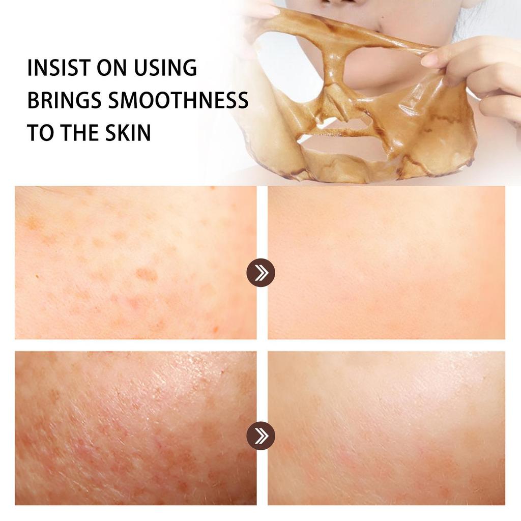 Spots Peel Off Facial Mask Freckle Pigmentation Removal Cream Chloasma Care Dark Spot Correction Glow Whiten Peeling Mask Strong