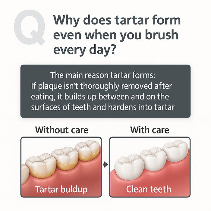2080 Dr. Klinische Zahnstein-Kontroll-Zahnpasta