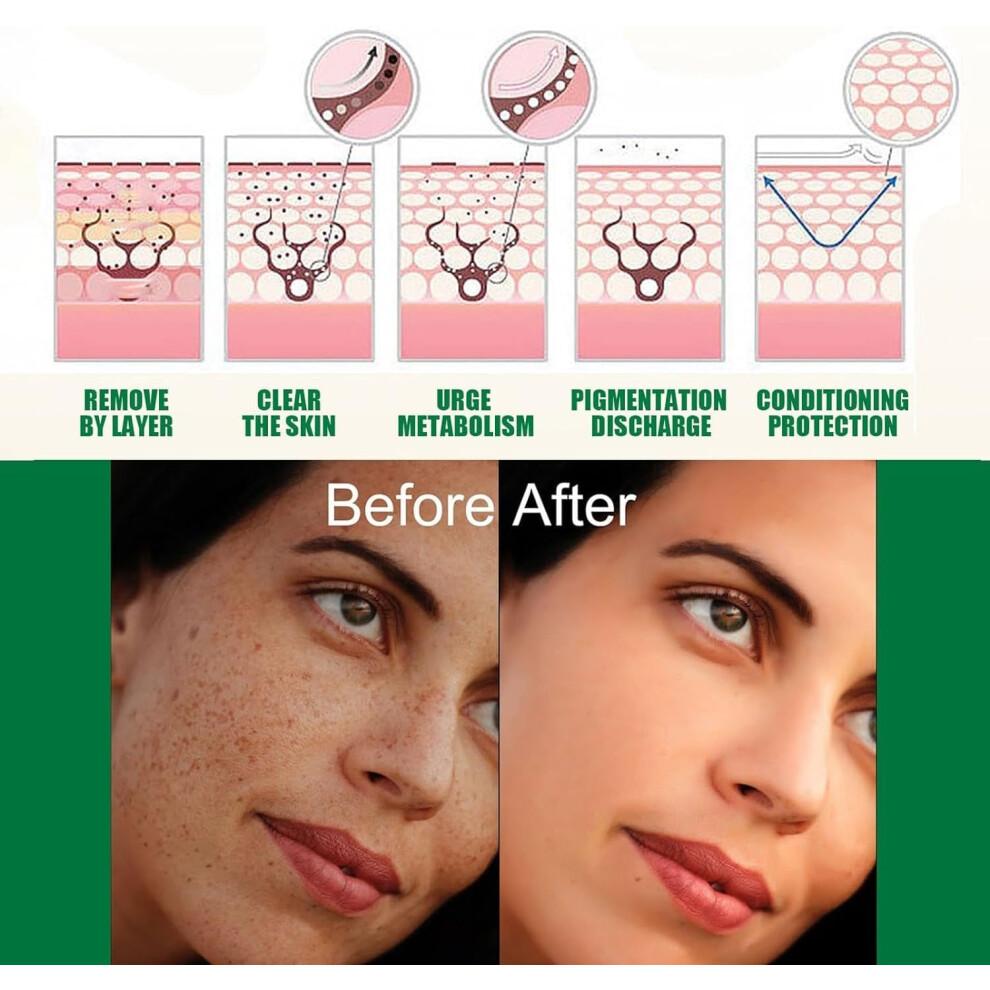 AXIS-Y Dark Spot Correcting Glow Serum 50ml / 1.69 fl. oz | Brightening Serum | Korean Skincare, Dark Spot Treatment, Hyperpigmentation Treatment