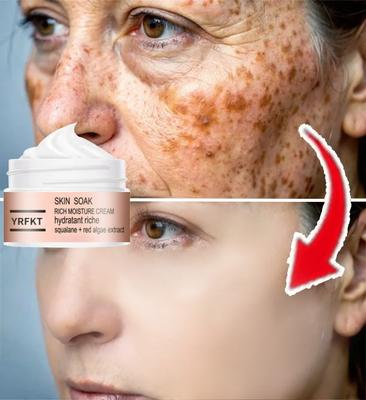 Nuova crema idratante per gli occhi, crema per il viso, vieni a migliorare insieme la pelle secca