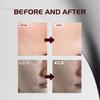 Alpha Arbutin & Tranexamic Acid Serum 50ml, Brightening Serum for Dark Spots, Acne Scars & Hyperpigmentation, Hydrating Face Serum for Sensitive Skin