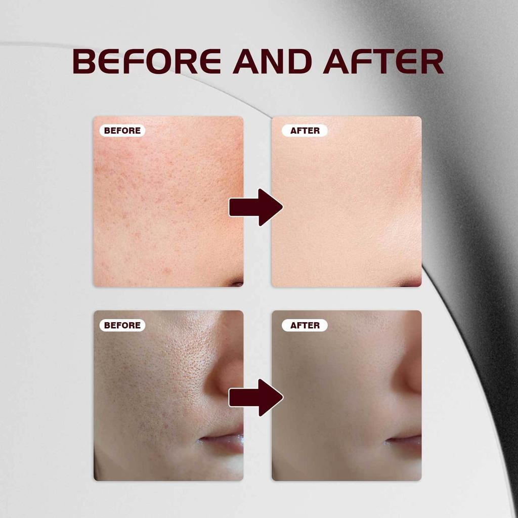 Alpha Arbutin & Tranexamic Acid Serum 50ml, Brightening Serum for Dark Spots, Acne Scars & Hyperpigmentation, Hydrating Face Serum for Sensitive Skin