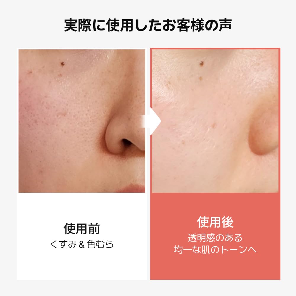 Redence Tone Spot Corrector Ampoule 30ml &