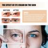 Jaysuing Eye Cream - Reduces Fine Lines And Dark Circles, Moisturizes Skin, Eye Care Tightening Cream